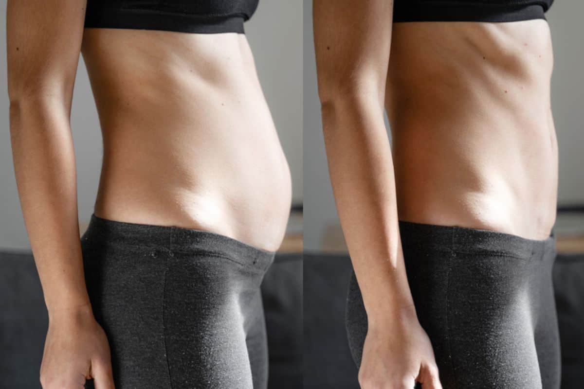 Post-Pregnancy: What Happens to Your Abdominal Muscles After Birth Sutton in Ashfield