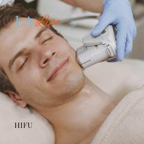 HIFU