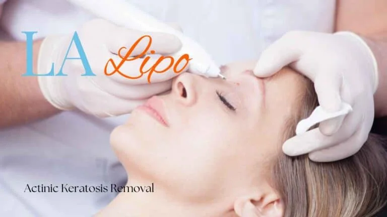 Woman receiving Actinic Keratosis Removal Treatment Sutton in Ashfield