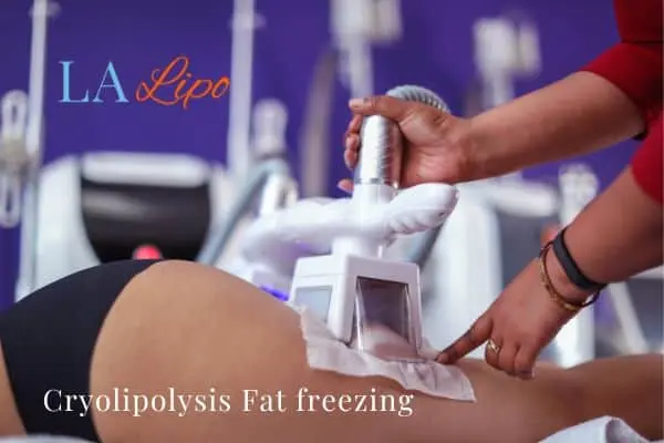 women getting fat freezing Sutton in Ashfield