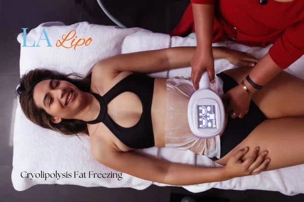 woman getting cryolipolysis Sutton in Ashfield