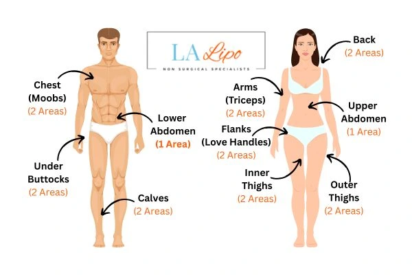 LA LIPO Cryolipolysis Areas Sutton in Ashfield