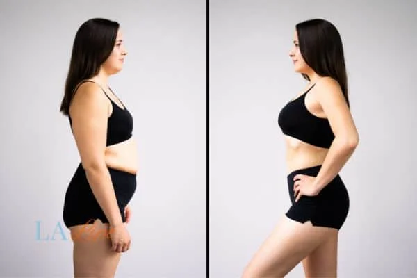 link between body image and mental health Sutton in Ashfield