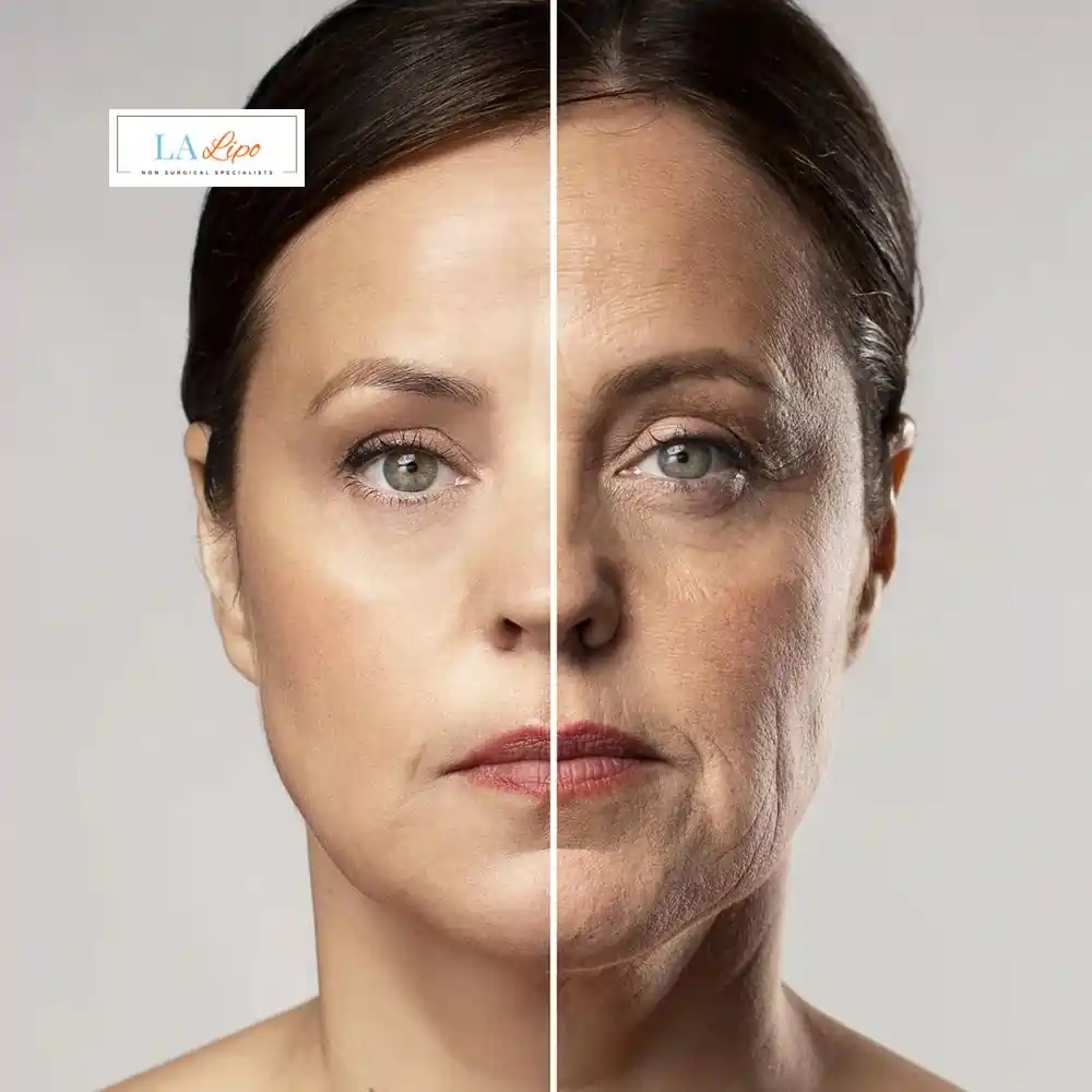 How Can You Tell If Non-Surgical Skin Tightening Is Right for You Sutton in Ashfield?