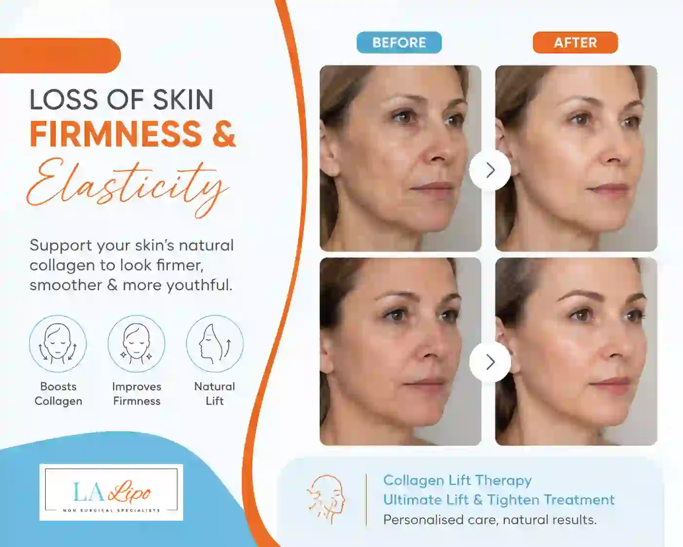 Sign #7: Loss of Skin Firmness and Elasticity Sutton in Ashfield